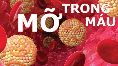 BỆNH MỠ TRONG MÁU ĐIỀU TRỊ BẰNG CÁCH NÀO?