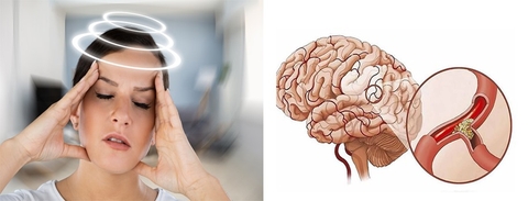 3 CÁCH ĐIỀU TRỊ VIÊM MÀNG NÃO: BAO LÂU THÌ CHỮA KHỎI HOÀN TOÀN?