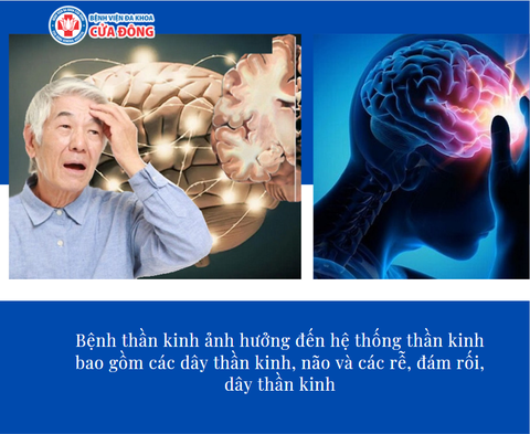 Mối quan hệ giữa căng thẳng và các bệnh về não và dạ dày