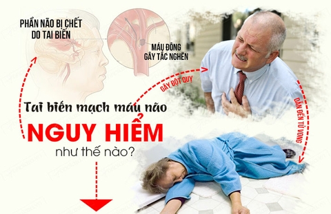 Những bệnh não nào có liên quan đến thoái hóa dây thần kinh?