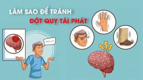Tại sao đột quỵ dễ tái phát và cách phòng ngừa?