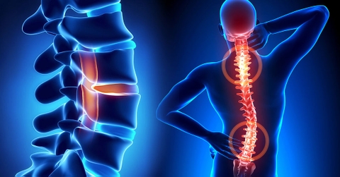 Viêm Khớp Là Gì? Nguyên Nhân, Triệu Chứng Và Cách Điều Trị Hiệu Quả