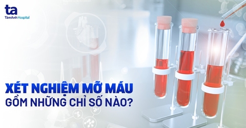 Hướng dẫn cách xem kết quả Cholesterol của bạn