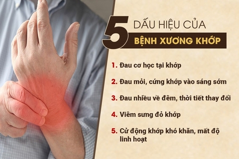 đau nhức xương khớp là bệnh gì