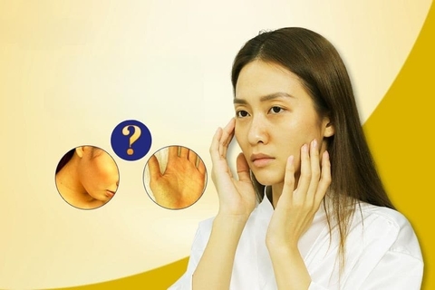 Da bị vàng thiếu chất gì