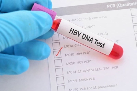 Định lượng hbv là gì?