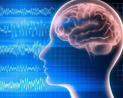 Điện não đồ là gì?