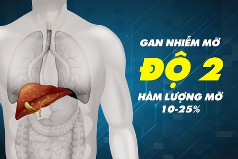 Gan nhiễm mỡ độ 2 là gì?