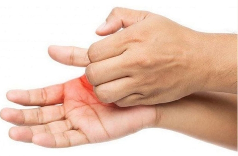 Ngứa lòng bàn tay do bệnh gan