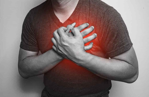 Tỷ lệ nhồi máu cơ tim sống sót