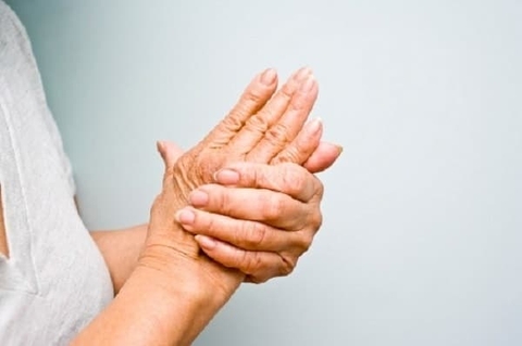 Yếu tay chân dấu hiệu cảnh báo đột quỵ