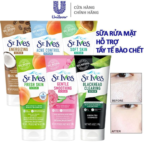 Sữa Rửa Mặt Có Hạt ST.IVES Tẩy Da Chết Chiết Xuất Thiên Nhiên