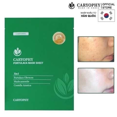 Mặt Nạ Miếng Caryophy Làm Dịu, Hỗ Trợ Phục Hồi Dành Cho Da Dầu Mụn Portulaca Mask Sheet 22g