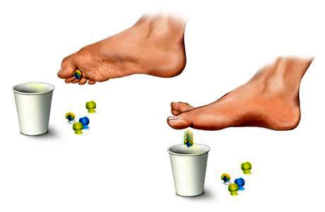 Bài tập mạnh cơ, đặc biệt là các cơ nội tại bàn chân
