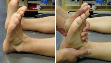 Xử trí bong gân mức độ nặng: Thực hiện các bài tập cho tầm vận động cổ chân, có giám sát một phần