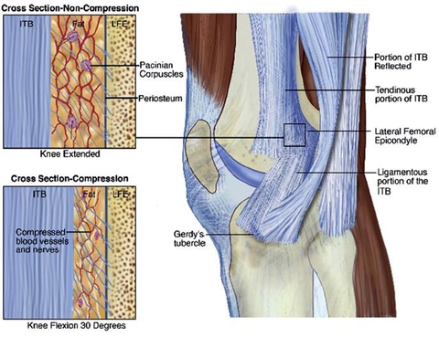 Chèn ép các thành phần phía trong dải chậu chày, đặc biệt ở 30 độ gập gối