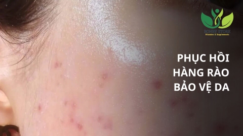 Những Cách Phục Hồi Hàng Rào Bảo Vệ Da Khoa Học, An Toàn Và Hiệu Quả
