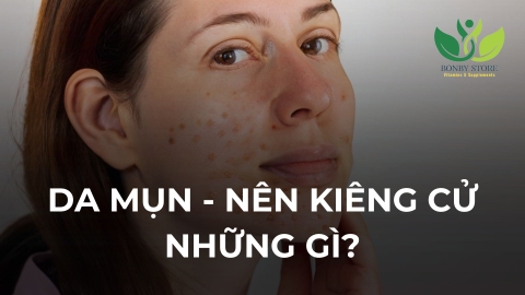 Những Loại Thực Phẩm Cần Kiêng Cữ Khi Da Mặt Có Nhiều Mụn: Hiểu Đúng Để Ngăn Ngừa Từ Gốc