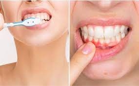 10 cách đơn giản để bảo vệ răng miệng mỗi ngày