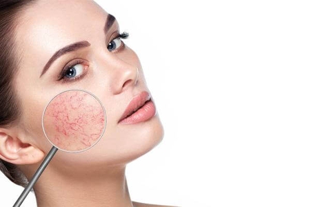 20 câu hỏi thường gặp về da nhạy cảm