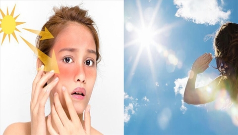 Làm thế nào để bảo vệ làn da nhạy cảm trước ánh sáng mặt trời?
