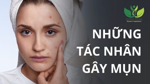Những Tác Nhân Gây Mụn: Hiểu Đúng Để Chăm Sóc Da Hiệu Quả