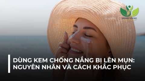 DÙNG KEM CHỐNG NẮNG BỊ LÊN MỤN: NGUYÊN NHÂN VÀ CÁCH KHẮC PHỤC