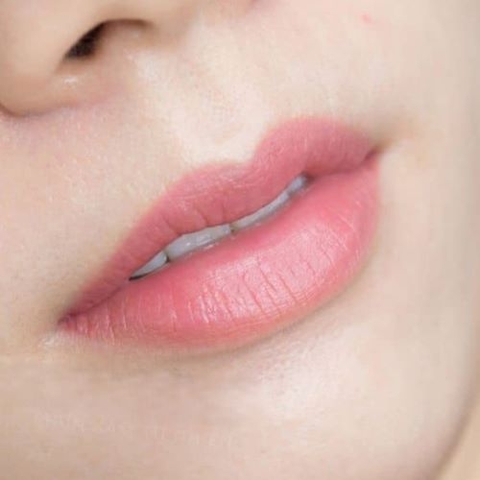Những vấn đề nào có thể xảy ra sau khi phun môi