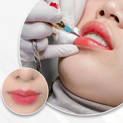 Hướng Dẫn Chăm Sóc Môi Sau Phun Môi Collagen