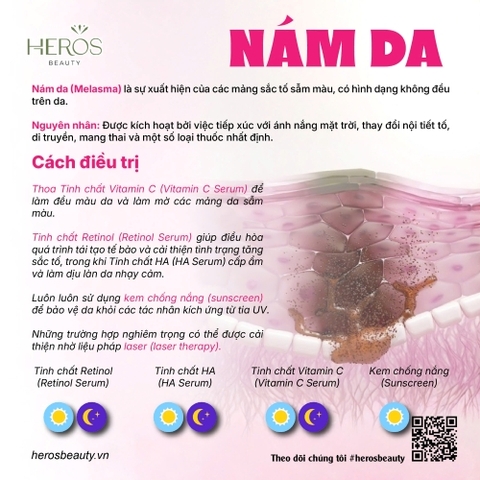 Những điều cần nhớ khi trị nám