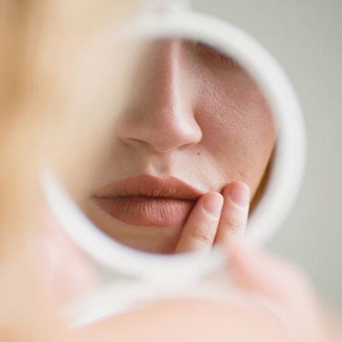 MÔI CĂNG, SƯNG, ĐỎ LÀ BỆNH GÌ?