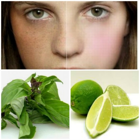 TRỊ NÁM TẠI NHÀ ĐƯỢC KHÔNG?