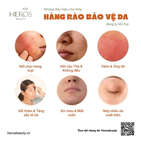 Những dấu hiệu cho thấy hàng rào bảo vệ da đang bị tổn hại