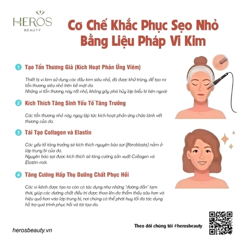 Cơ chế khắc phục sẹo nhỏ bằng liệu pháp vi kim