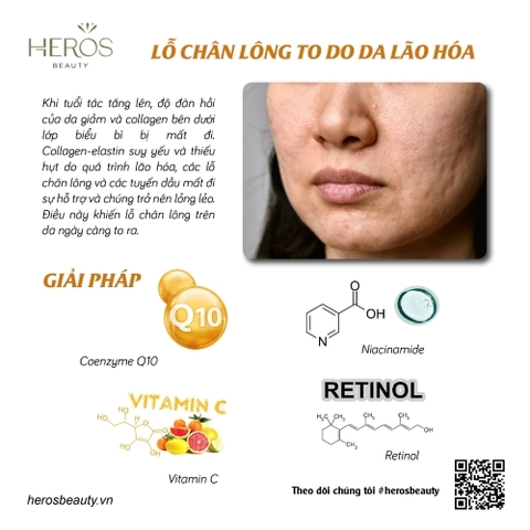 Giải pháp cải thiện hiệu quả tình trạng lỗ chân lông to do da lão hóa