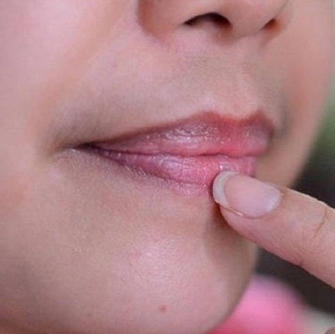 MÔI THÂM TÍM- DẤU HIỆU CẢNH BÁO NGUY HẠI SỨC KHOẺ