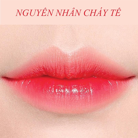Các nguyên nhân gây cháy tê sau phun môi