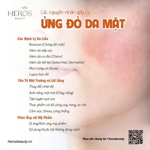 Các nguyên nhân gây ra ửng đỏ da mặt và giải pháp xử lý hiệu quả