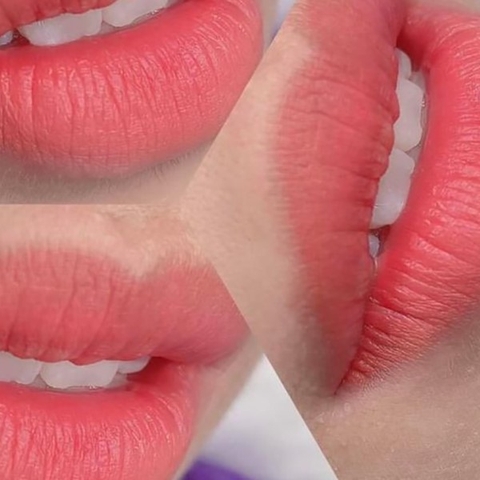 CƠ ĐỊA NHƯ THẾ NÀO DỄ PHẢN ỨNG SAU PHUN MÔI?