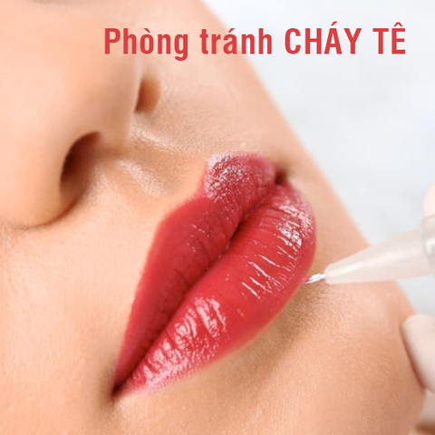 Các phương pháp phòng tránh cháy tê sau phun môi