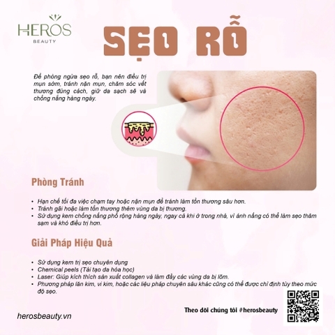 Giải pháp phòng tránh và đặc trị sẹo rỗ hiệu quả