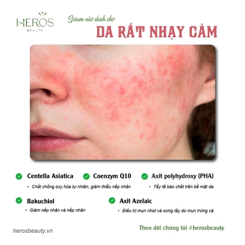 SERUM NÀO DÀNH CHO DA RẤT NHẠY CẢM?