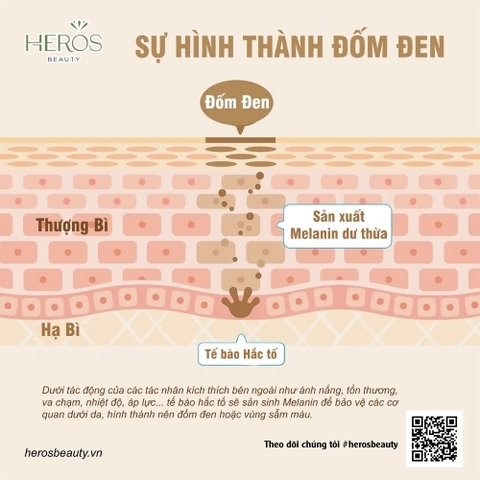 Sự hình thành của đốm đen và giải pháp ngăn ngừa hiệu quả