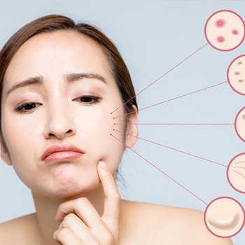 Ánh nắng mặt trời gây tổn thương da như thế nào?