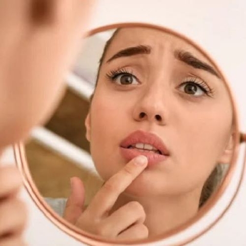 TẨY TẾ BÀO CHẾT MÔI ĐỂ ĐIỀU TRỊ MÔI NỨT NẺ