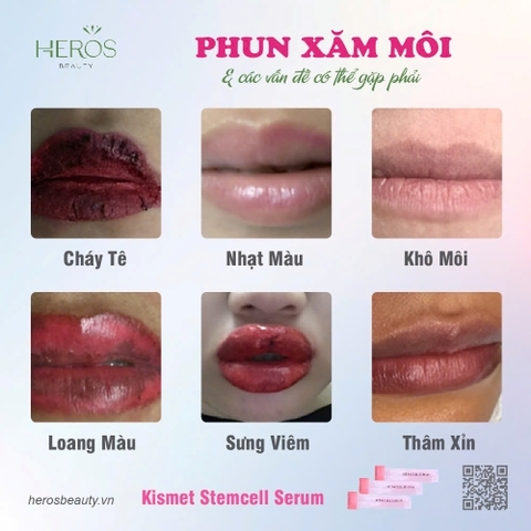 CÁC VẤN ĐỀ CÓ THỂ GẶP PHẢI KHI PHUN XĂM MÔI