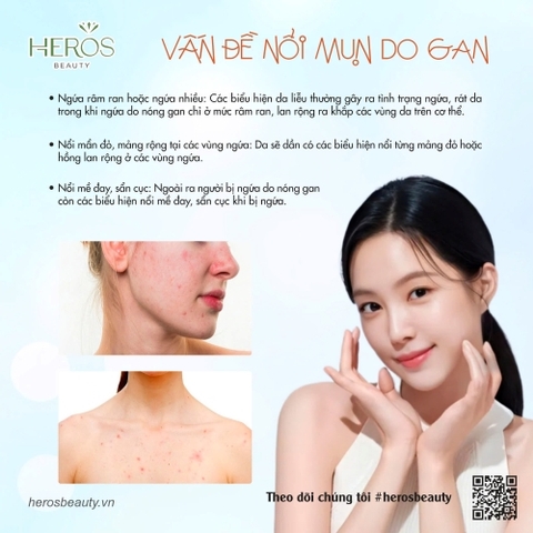 TRIỆU CHỨNG PHỔ BIẾN CỦA NỔI MỤN DO GAN