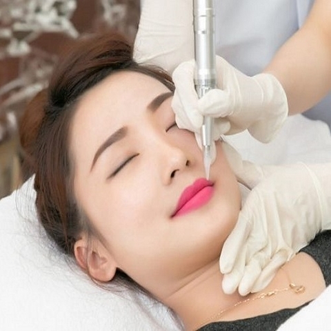 Phun Môi Thẩm Mỹ - Những Điều Cần Biết