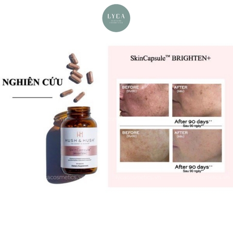 [HUSH AND HUSH] THỰC PHẨM CHỨC NĂNG CHĂM SÓC TOÀN DIỆN SỨC KHỎE VÀ LÀN DA SHIELD UP, SKINCAPSULE BRIGHTEN+, SKINCAPSULE HYDRATE+, TIME CAPSULE, SKINCAPSULE CLEAR+, TIME CAPSULE