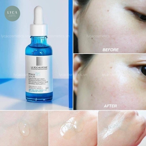 [LA ROCHE-POSAY] Tinh chất dưỡng sáng, chống lão hóa, giảm thâm nám, tái tạo & phục hồi da B3, B5 và Vitamin C10